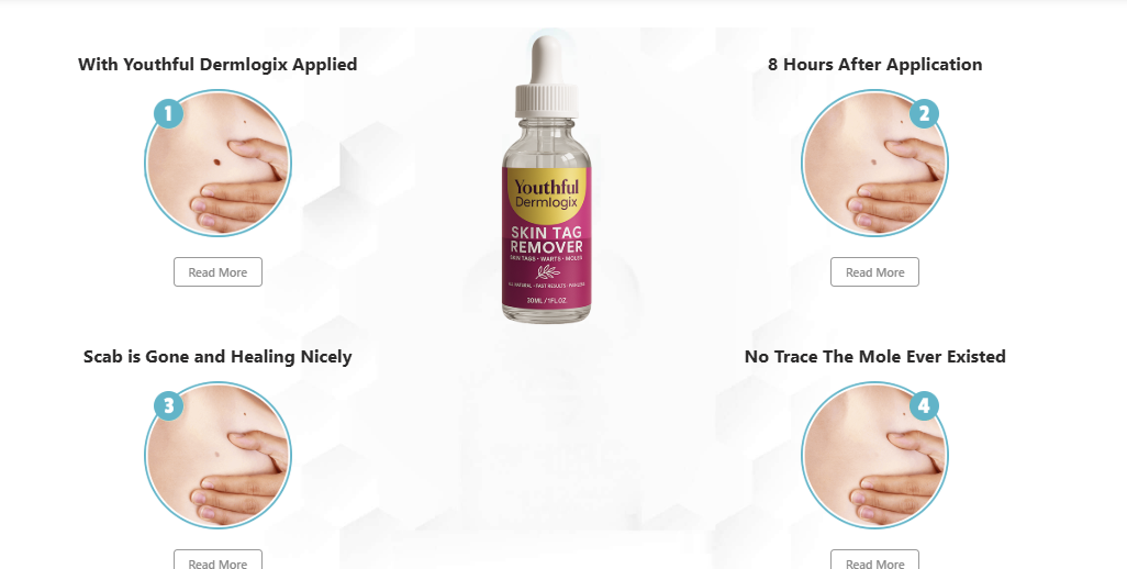 Youthful Dermlogix Skin Tag Remover shop
